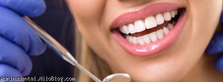 میزان موفقیت ایمپلنت دندان و ادغام آن با استخوان فک